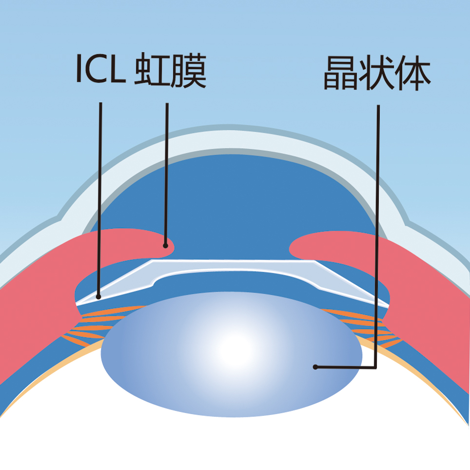 巅峰对决,眼科医师如何打败散打冠军