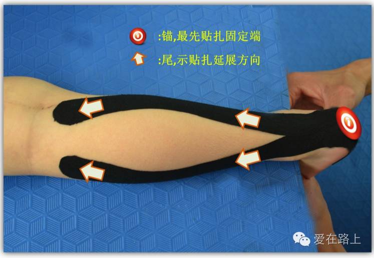 【建言献策】尖足的处理