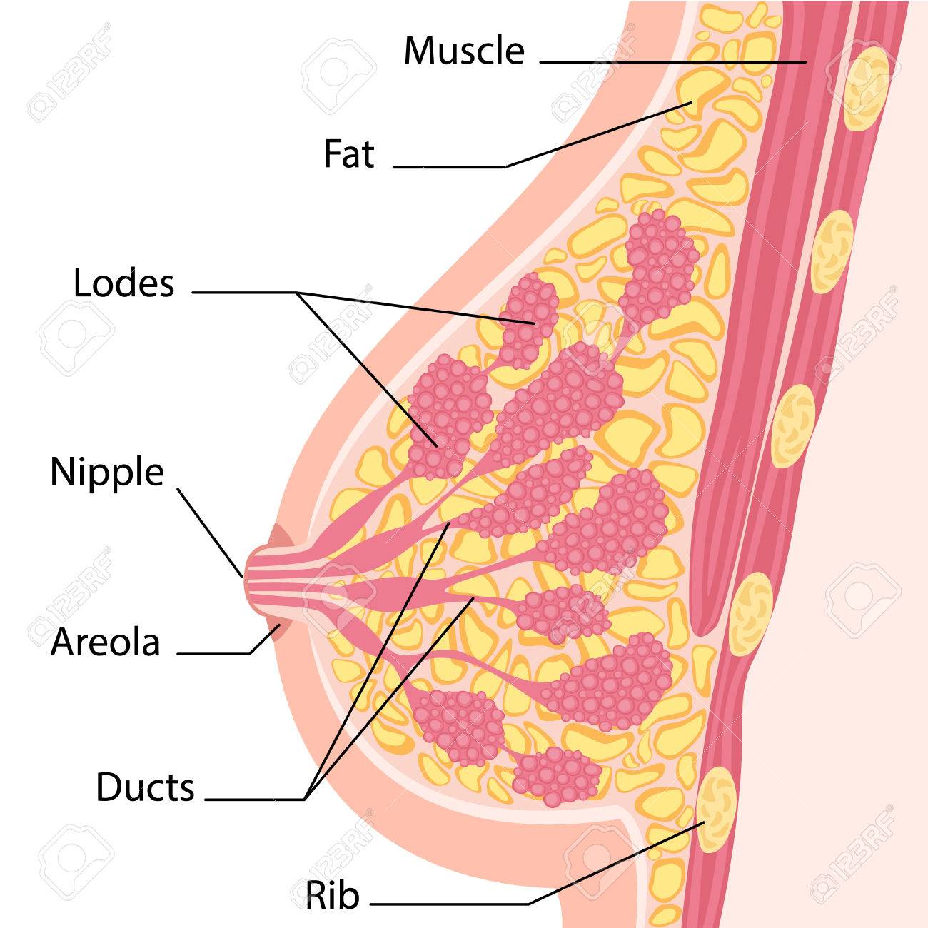 三,下垂分級國際上通過評估乳頭相對於乳房下皺襞的位置,即乳房下側