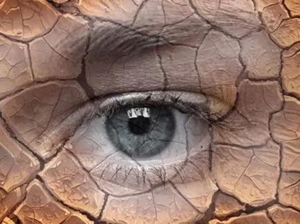 治疗干眼时你最容易踏入这些误区