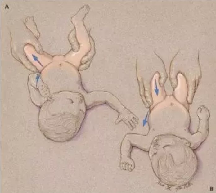 蛙抱宝宝的姿势蛙式图片
