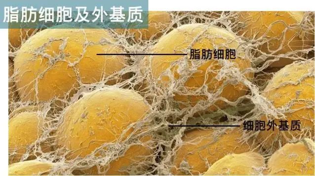 想做脂肪填充?纳米脂肪,svf脂肪胶,prp你搞清楚了吗?