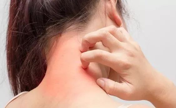 痛感,当皮肤过敏长期没有好转时,就会触及到神经系统,所以就会出现