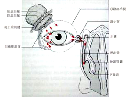 皮肤松弛症案例视频泪腺脱垂重睑案例三,鉴别诊断泪腺炎,眶脂肪脱垂