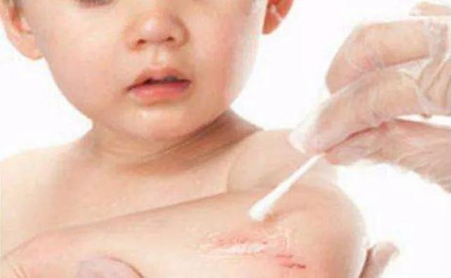 儿科医生告诉你：宝宝受外伤时该怎么处理才正确？