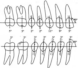 标准牙倾斜度示意图图片