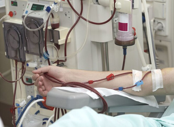 尿毒症的治疗方法有三种有一种最好疗法但要等时机