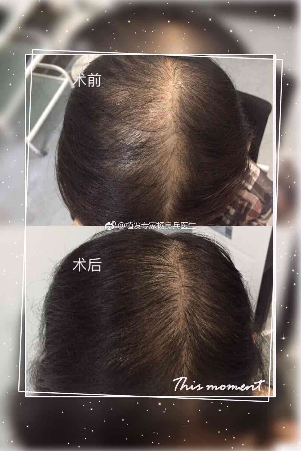 头发加密效果