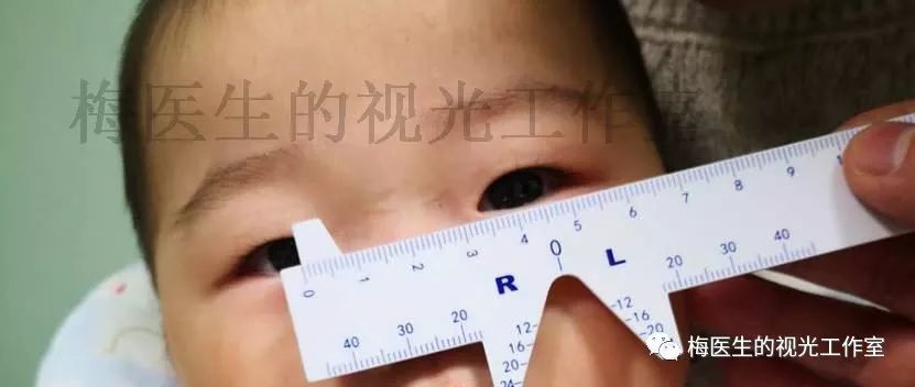 先天性白内障术后患儿宝宝怎么办?