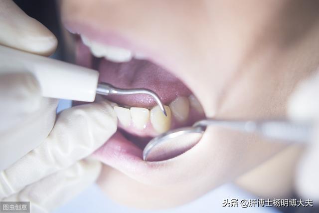 牙龈出血是肝病加重了吗?