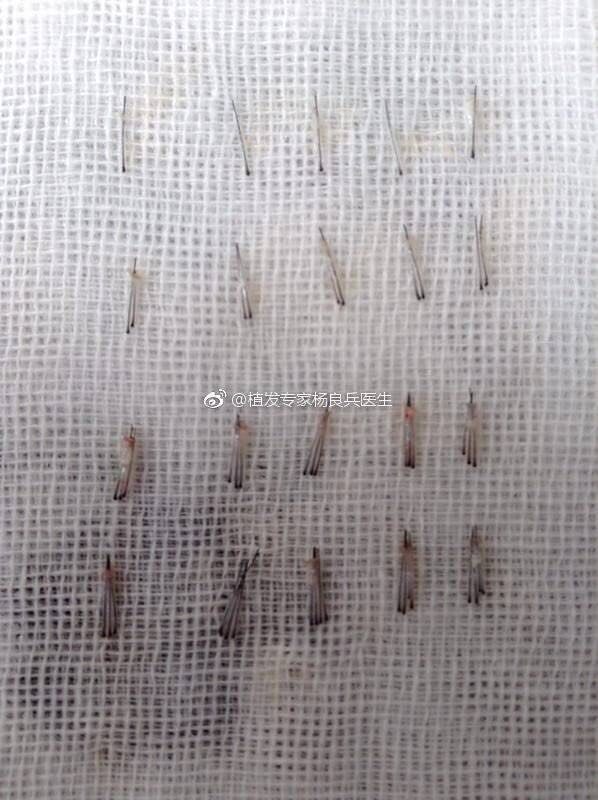 毛囊与毛囊单位