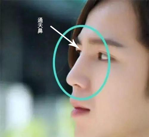 为什么鼻子侧面看足够立体,正面看却矮塌塌?