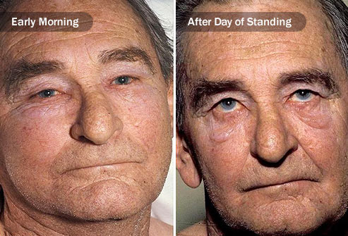 肺癌早期症状只有咳嗽?这些变化同样重要,希望你没有