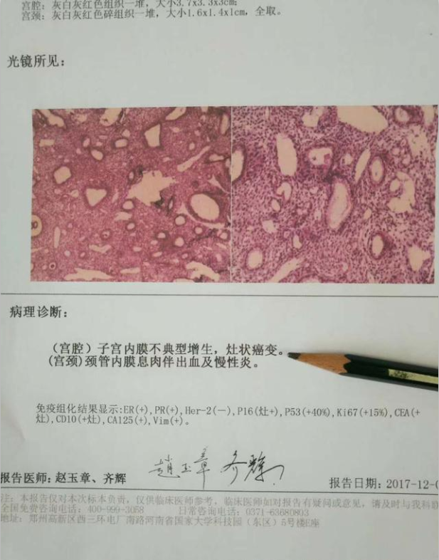 腺肌症绝经后=人间天堂,高枕无忧?