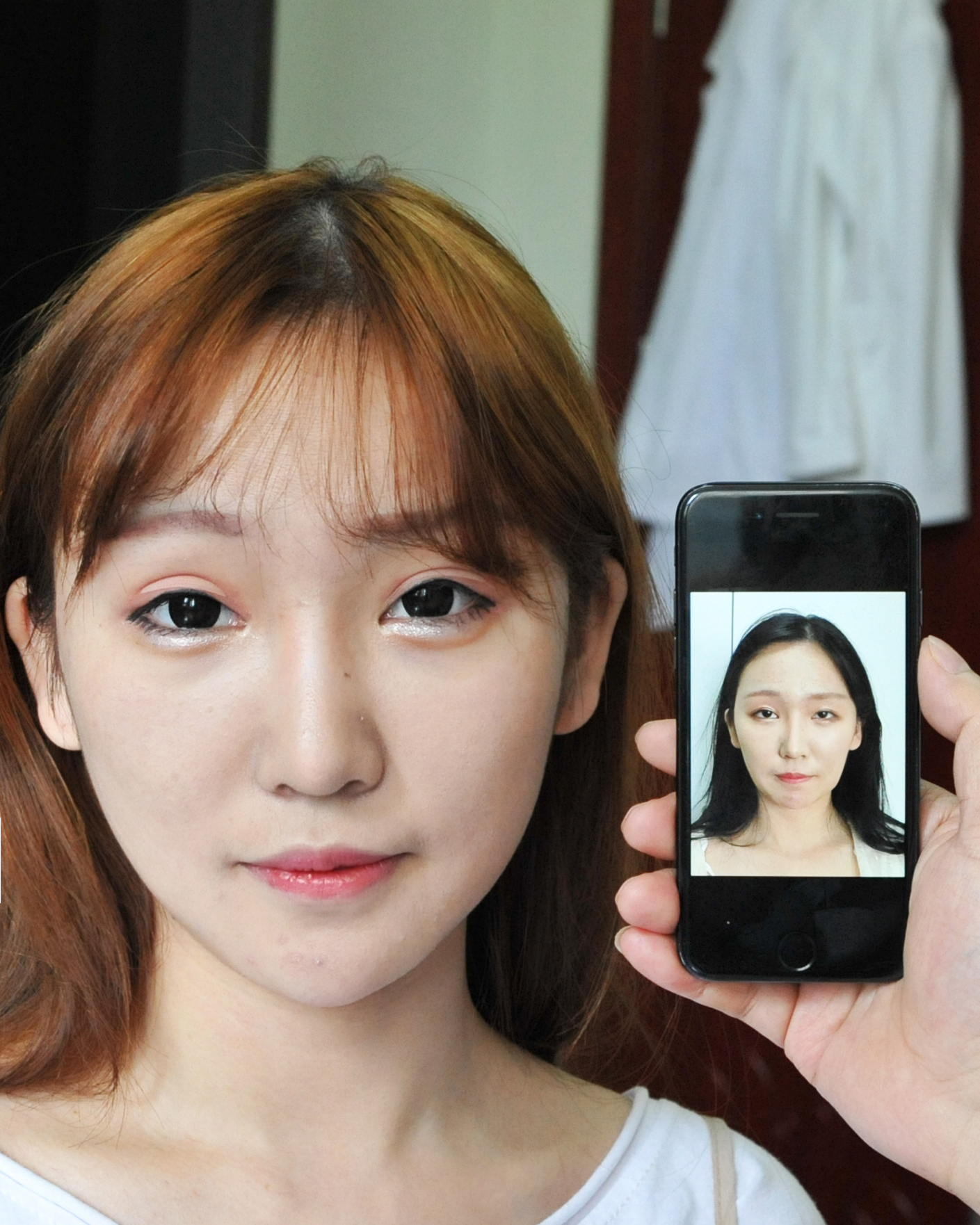 改脸型案例展播