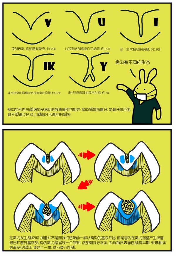 牙齿上刷不掉的"黑线"是什么?