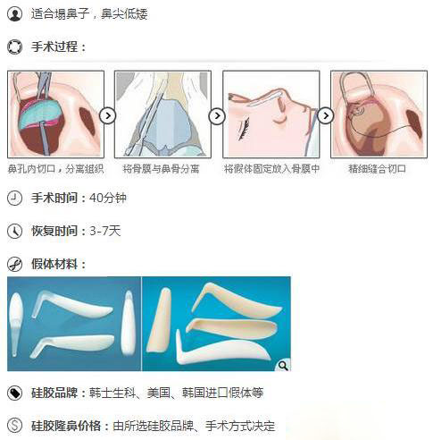 为什么你的鼻子不够完美?看了这些你就知道