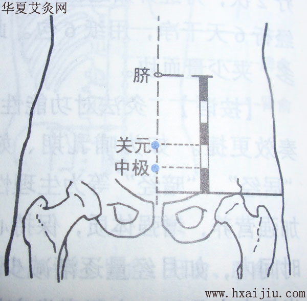 避免猝死长寿章法在此