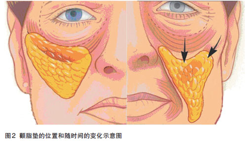 正畸风险:时间带来的面部软组织变化
