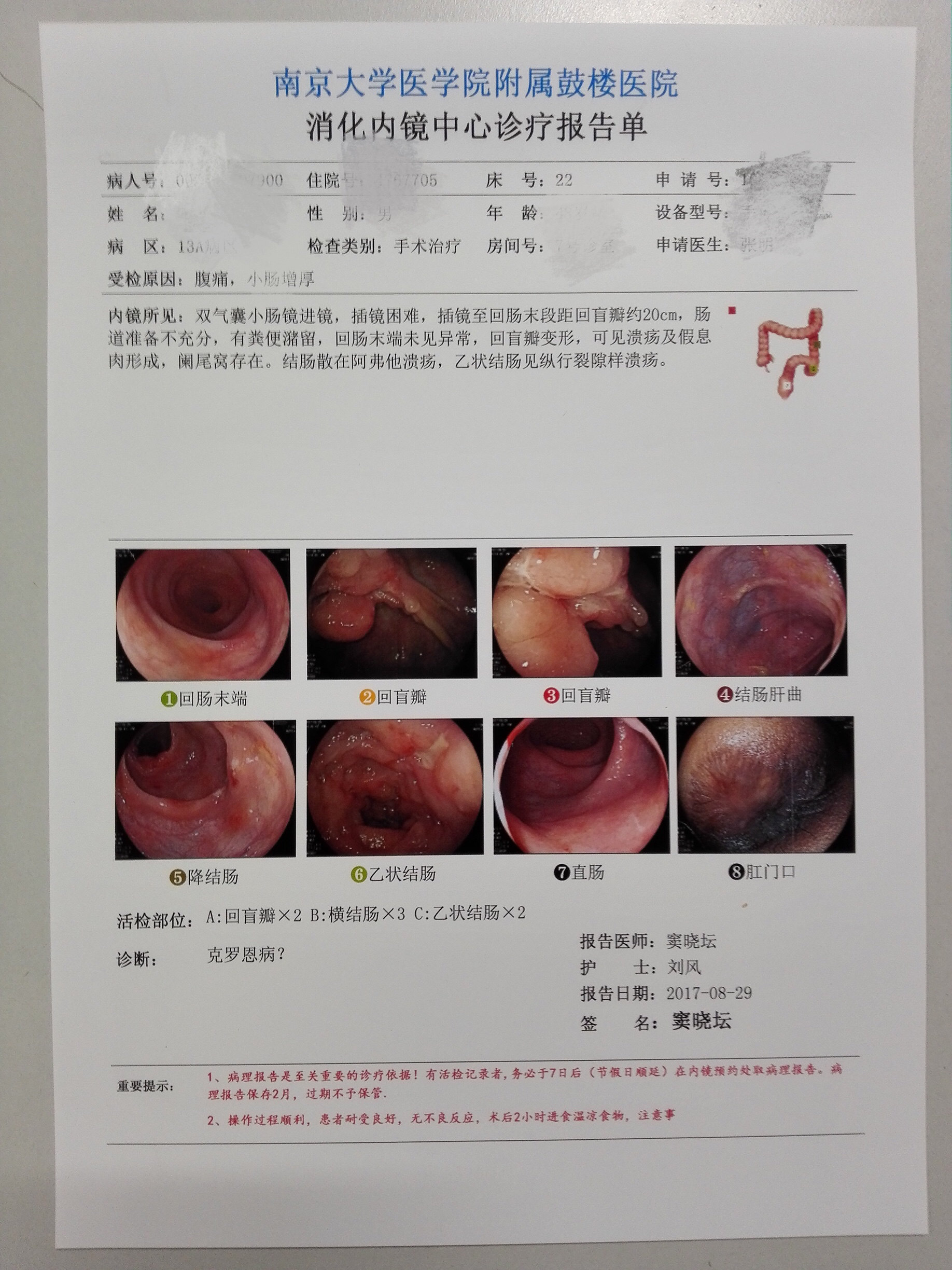 克罗恩病的主要症状为腹痛,腹泻,体重下降.