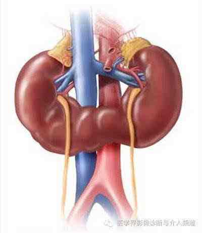 诊间日记马蹄肾