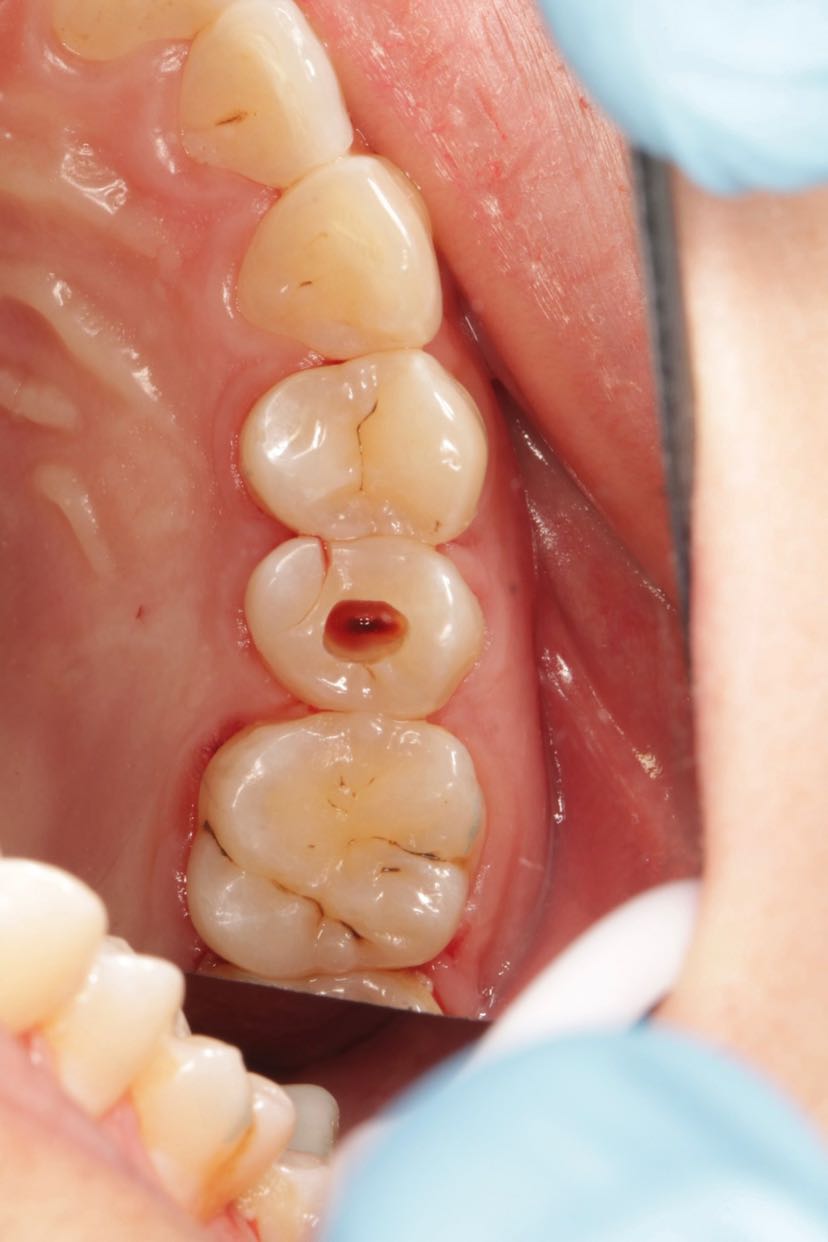 程乐的诊间日记20211214