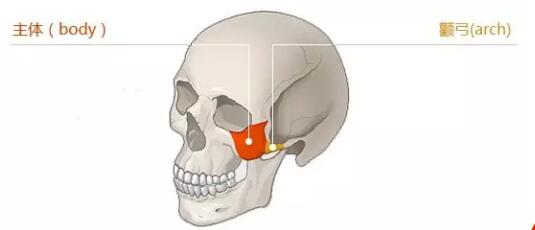 真性颧骨凸出:颧骨体或者颧弓发育异常,外在表现就是:高颧骨,面中部过