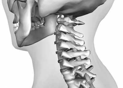 脖子疼就是颈椎病?NO,确诊颈椎病需要依据这