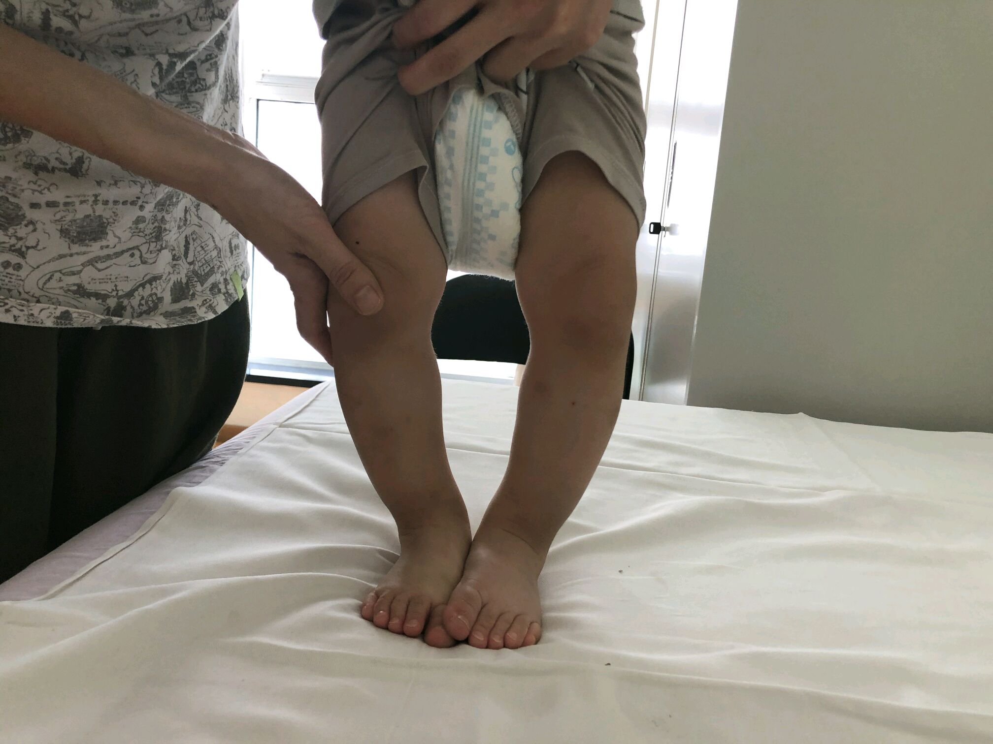 小孩膝盖超伸图片