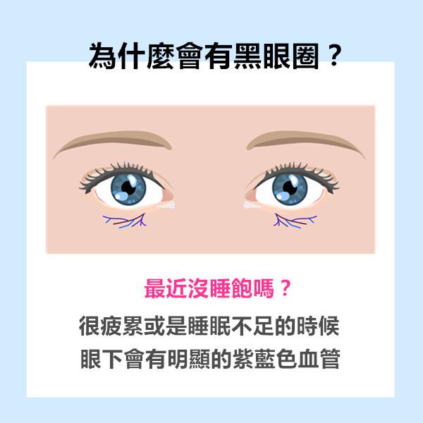 黑眼圈这么难看 能去除吗 要怎么去 厉立辉 爱问医生