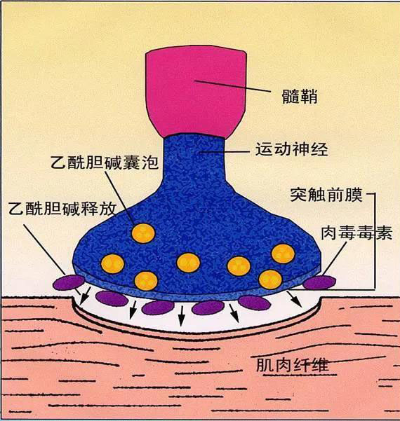 关于肉毒素你想知道的和你一定要知道的事