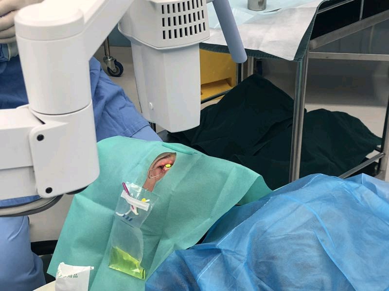 近视手术到底分几种?