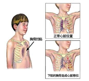 因为这个坑我们与其他孩子不一样,跟不上同龄孩子的发育.