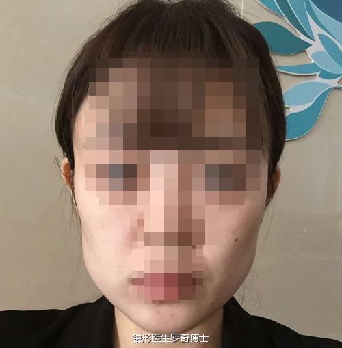 《金刚腮覆灭记》——现在简直美炸天!