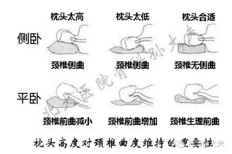 尤其是蛙泳,標準的蛙泳換氣動作是對頸椎曲度最好的鍛鍊方法