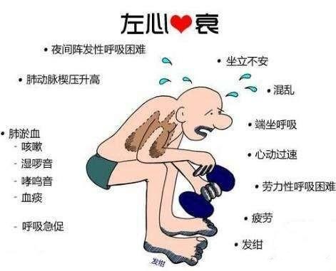 心衰·老人.jpg