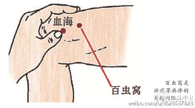 現在患者癢不減,諸痛腫癢,皆屬於心,於是刺左神門右內關,得氣,針下