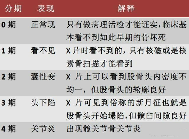什么是股骨头坏死股骨头坏死应该如何治疗看医生怎么说的吧