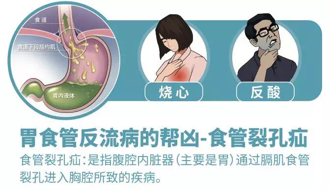 正常情况下,我们吃饭后不会出现胃食管反流,是因为