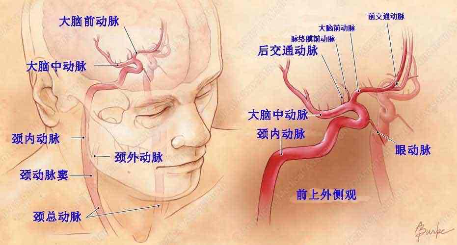 脑底动脉环与脑血管疾病