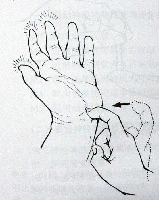 屈腕试验(phalen征)阳性率在70%左右:屈肘,前臂上举,双腕同时屈曲90