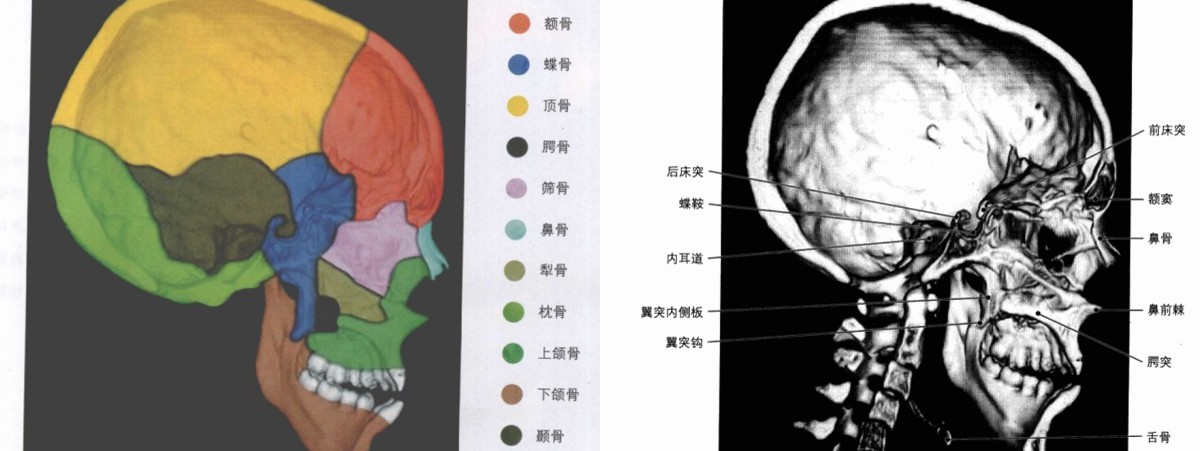 颅骨解剖