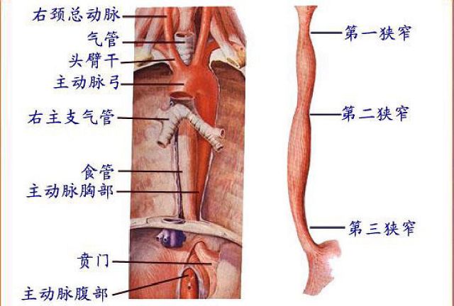 食管的三个狭窄图片