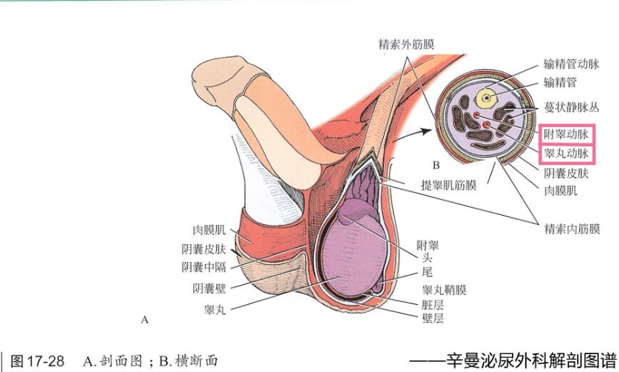 阴囊水平的睾丸动脉与附睾动脉阴囊入路的显微精索结扎术难度大,因为