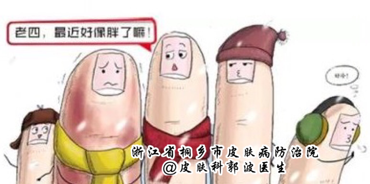 局部外用一些活血化瘀的药膏,如喜辽妥乳膏,肝素软膏,冻疮膏,维生素e