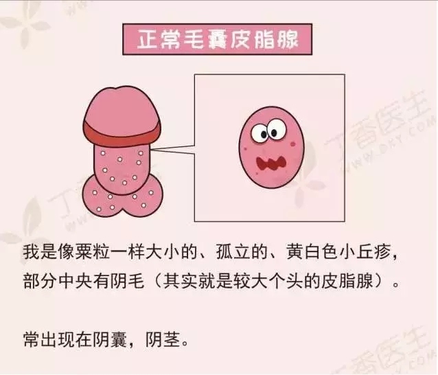 解惑丁丁上的小点点什么东东