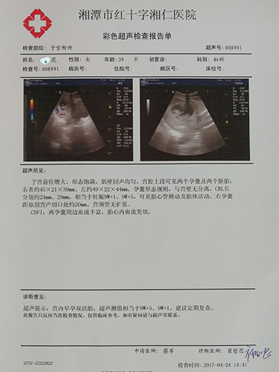 子宫内膜异位症根治的最佳办法是生孩子