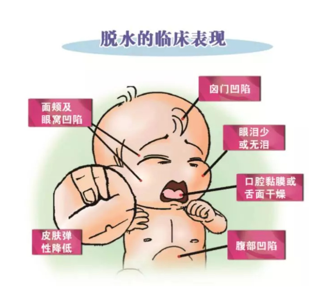 娃腹泻不止,可能是"轮状病毒"惹的祸