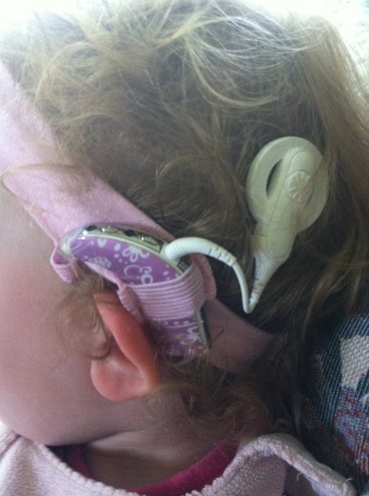 人生就是如此,人工耳蜗/助听器艺术展 4