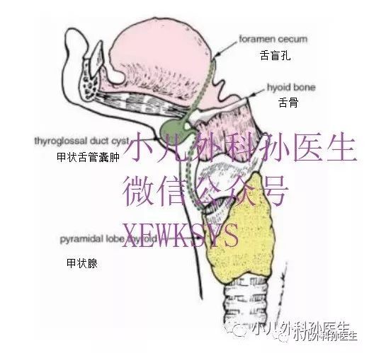 甲状舌管囊肿解剖位置图片